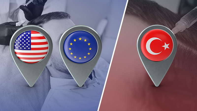 Turkey vs USA/Europe Hair Transplant Comparison